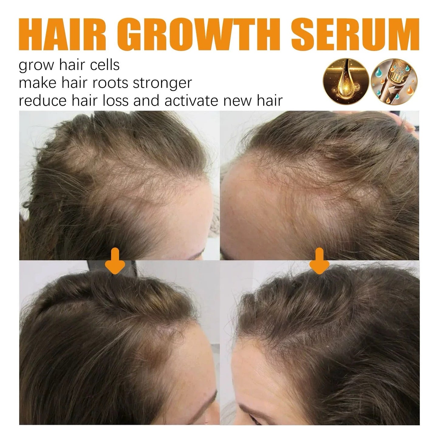 š„Final 3 Hours: 80% OFF - ODALIT⢠Biotin Hair Growth Serum