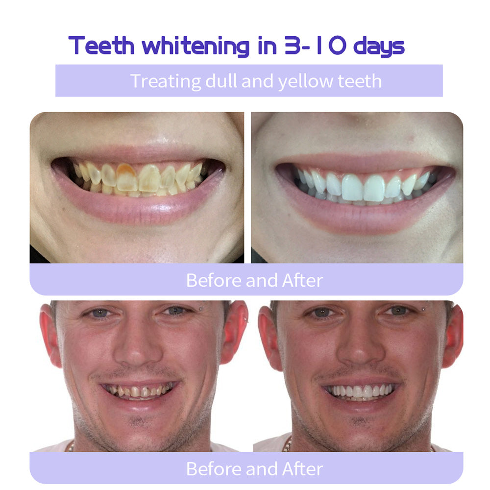 đĽFinal 3 Hours: 80% OFF - ODALIT⢠Fluoride-Free Nano-Hydroxyapatite Toothpaste