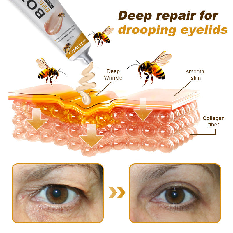 🔥Final 3 Hours: 80% OFF - ODALIT™ Botox Bee Venom Wrinkle Removal Cream🐝