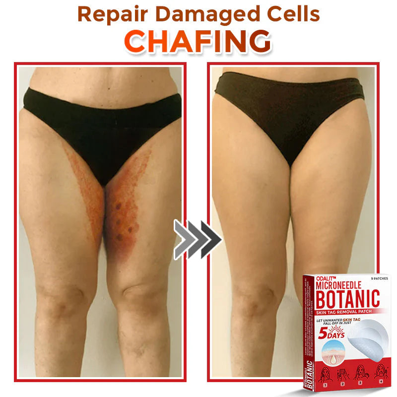 🔥Final 3 Hours: 80% OFF - ODALIT™ MicroNeedle Botanic Skin Tag Removal Patch 🇺🇸 Made in the USA