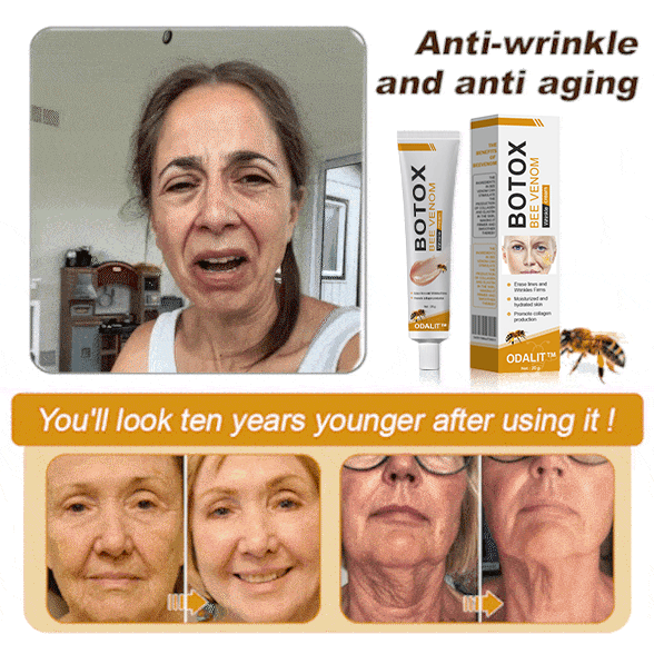 🔥Final 3 Hours: 80% OFF - ODALIT™ Botox Bee Venom Wrinkle Removal Cream🐝
