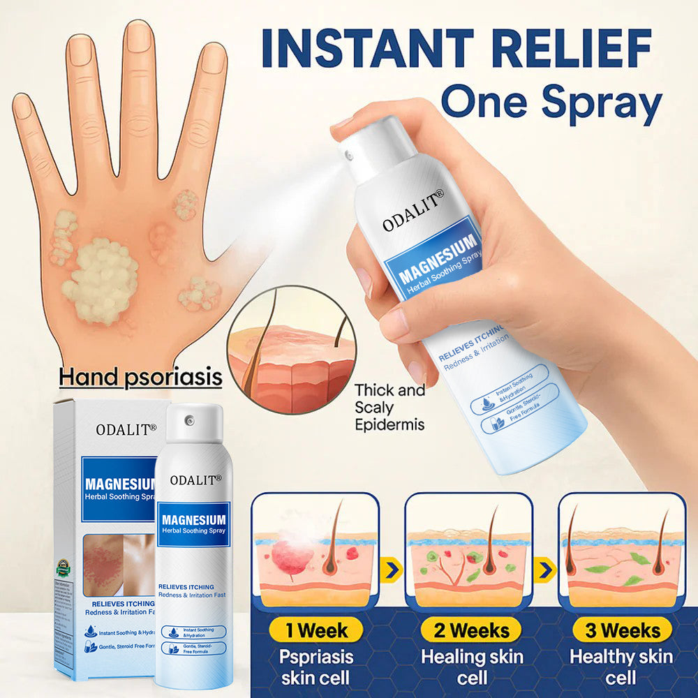 🔥Final 3 Hours: 80% OFF - ODALIT® Magnesium Herbal Soothing Spray