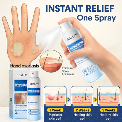 🔥Final 3 Hours: 80% OFF - ODALIT® Magnesium Herbal Soothing Spray