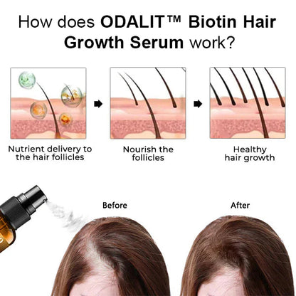 🔥Final 3 Hours: 80% OFF - ODALIT™ Biotin Hair Growth Serum