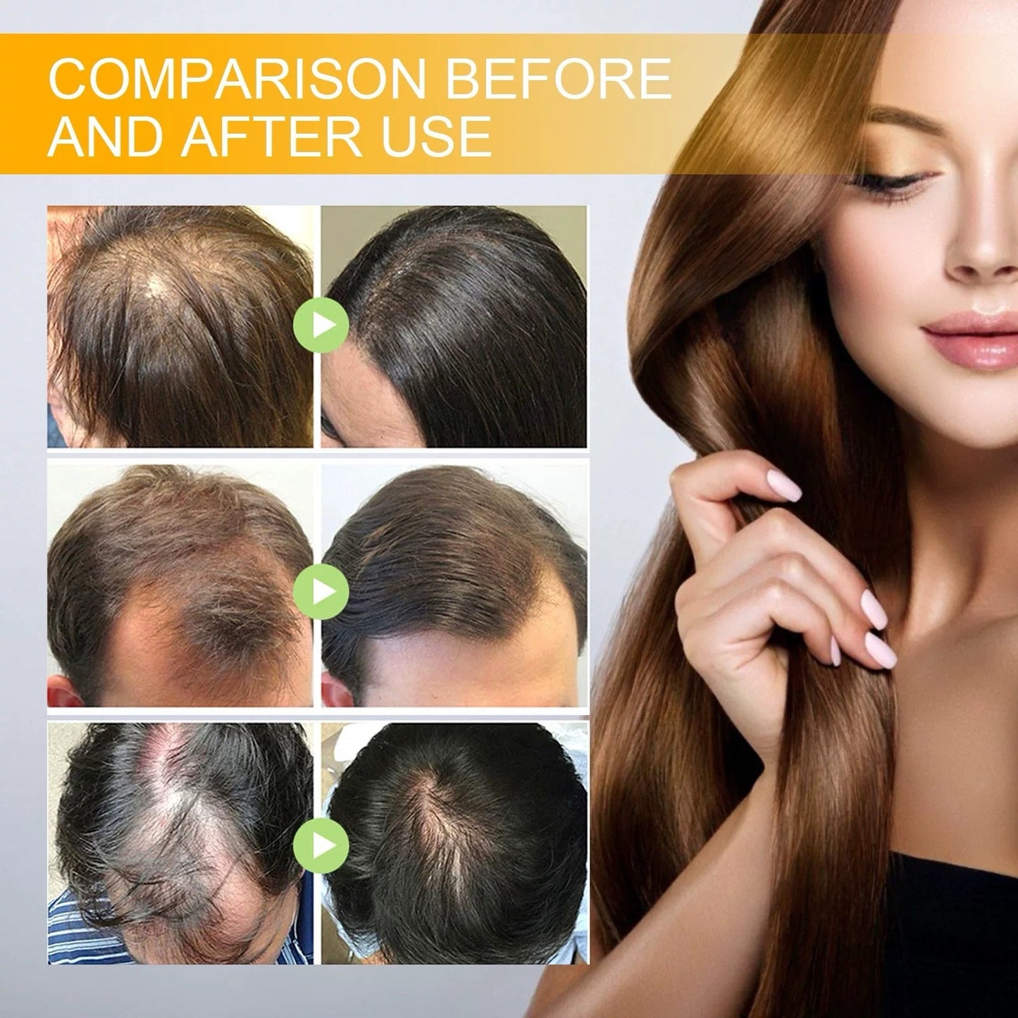🔥Final 3 Hours: 80% OFF - ODALIT™ Biotin Hair Growth Serum