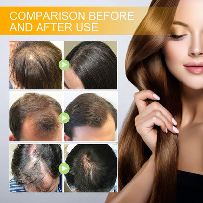 🔥Final 3 Hours: 80% OFF - ODALIT™ Biotin Hair Growth Serum