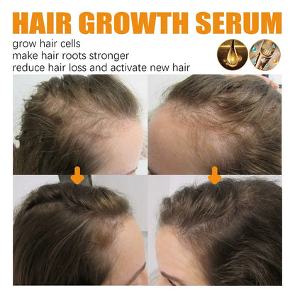 🔥Final 3 Hours: 80% OFF - ODALIT™ Biotin Hair Growth Serum