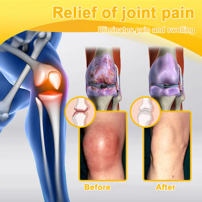 🔥Final 3 Hours: 80% OFF - ODALIT™ Botulinum Toxin & Bee Venom Pain-Relief Bone Healing Cream🐝
