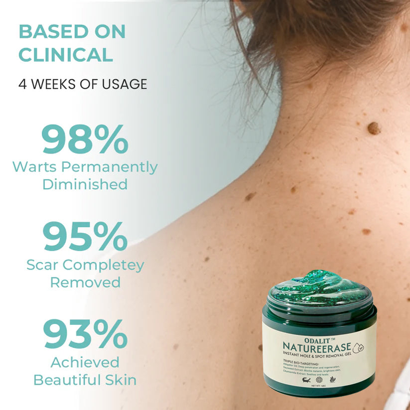 ✅ Official Store: ODALIT™ NatureErase Instant Alligator Oil Mole & Spot Removal Plus Gel