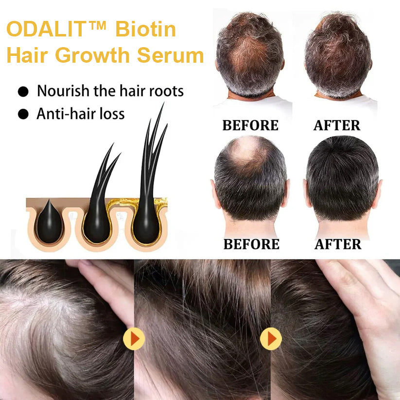 🔥Final 3 Hours: 80% OFF - ODALIT™ Biotin Hair Growth Serum