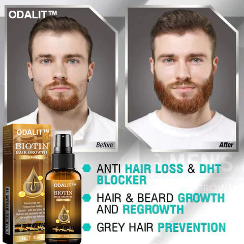 🔥Final 3 Hours: 80% OFF - ODALIT™ Biotin Hair Growth Serum