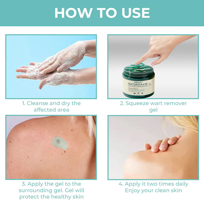 ✅ Official Store: ODALIT™ NatureErase Instant Alligator Oil Mole & Spot Removal Plus Gel