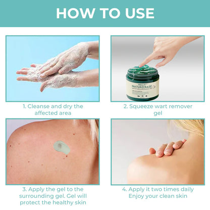 ✅ Official Store: ODALIT™ NatureErase Instant Alligator Oil Mole & Spot Removal Plus Gel