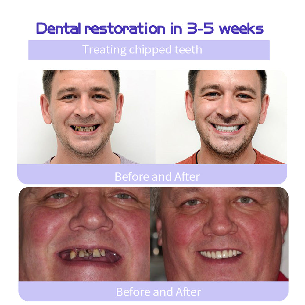 🔥Final 3 Hours: 80% OFF - ODALIT™ Fluoride-Free Nano-Hydroxyapatite Toothpaste