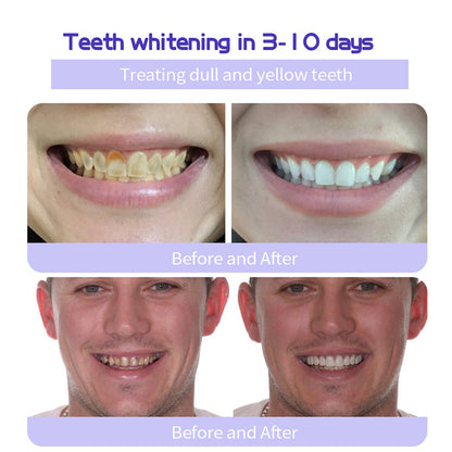 🔥Final 3 Hours: 80% OFF - ODALIT™ Fluoride-Free Nano-Hydroxyapatite Toothpaste