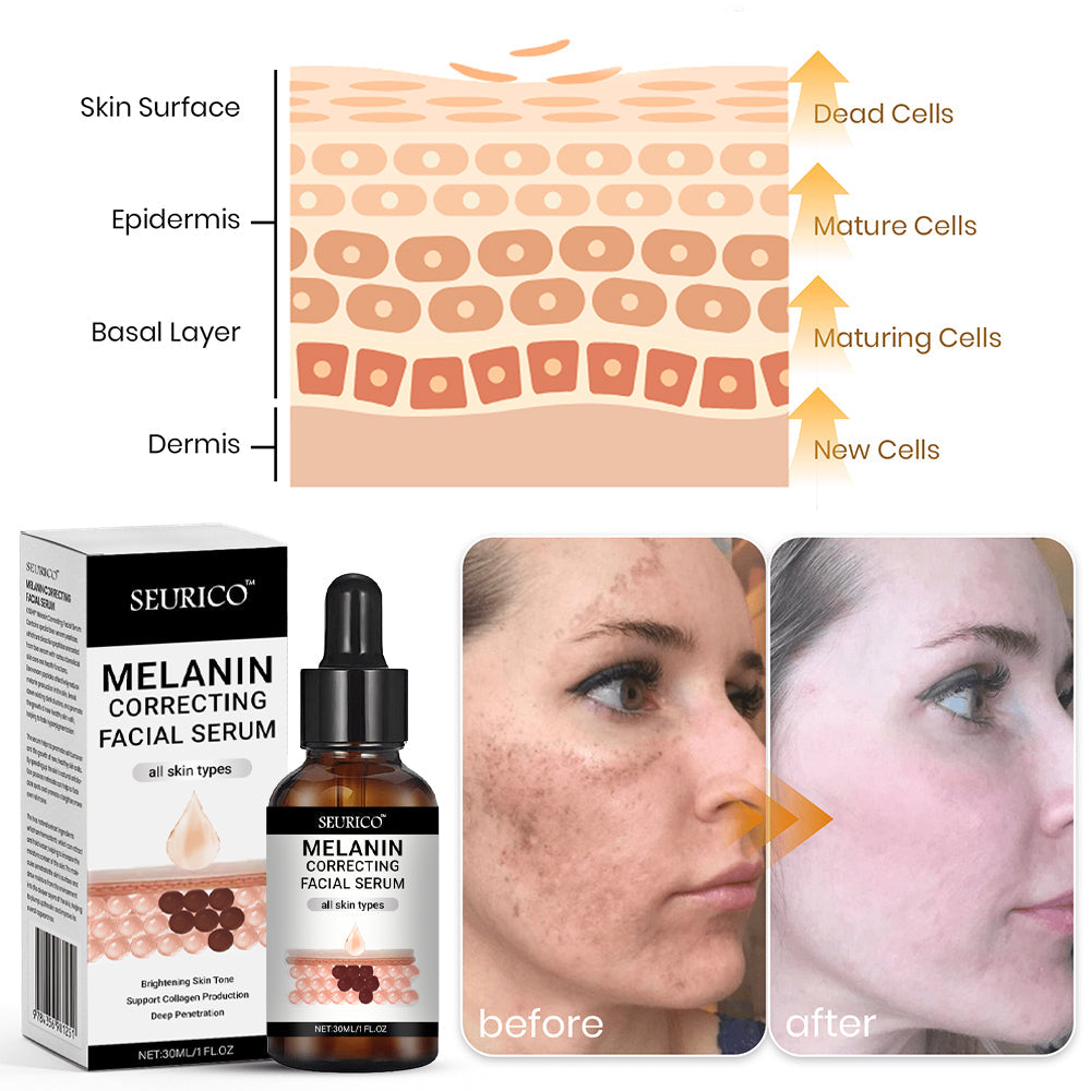 🔥Final 3 Hours: 80% OFF - SEURICO™ Melanin Correcting Facial Serum –  Rapid Dark Spot Eraser