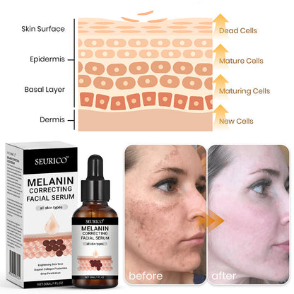 🔥Final 3 Hours: 80% OFF - SEURICO™ Melanin Correcting Facial Serum –  Rapid Dark Spot Eraser